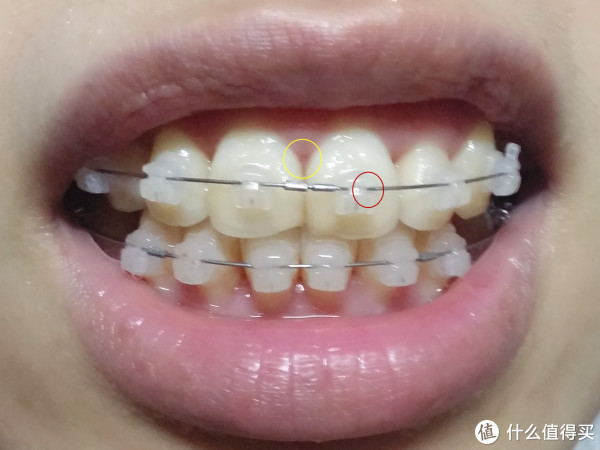 松下EW-DJ10口腔冲洗器使用总结(优点|不足|携