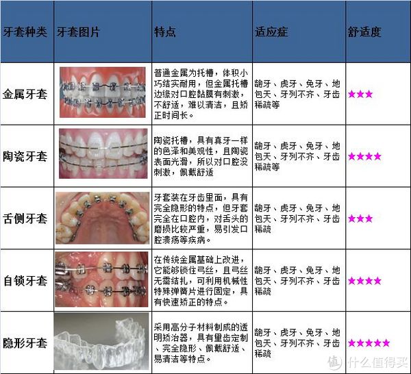 牙套的种类   普通的金属牙套最便宜,国产的2000￥就能下来,好一些的