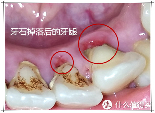 口腔护理之牙膏使用报告