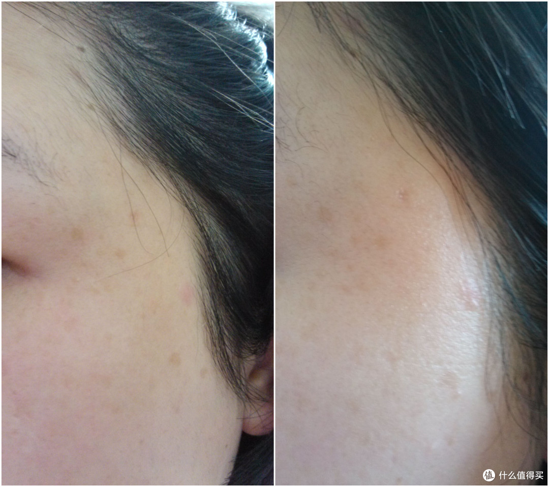最后上一张脸部使用前后图,因为脸上有斑点.