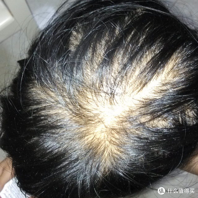 丰添防脱洗发液测评报告