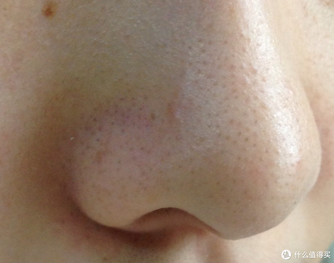 【真人秀】草莓鼻也有春天：韩国 CNP 希恩派 皮肤科医院 黑头清洁 管理专用鼻贴