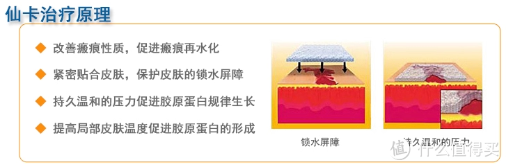 剖腹产妈妈亲测——CICA-CARE仙卡祛疤贴 自粘性硅胶贴片