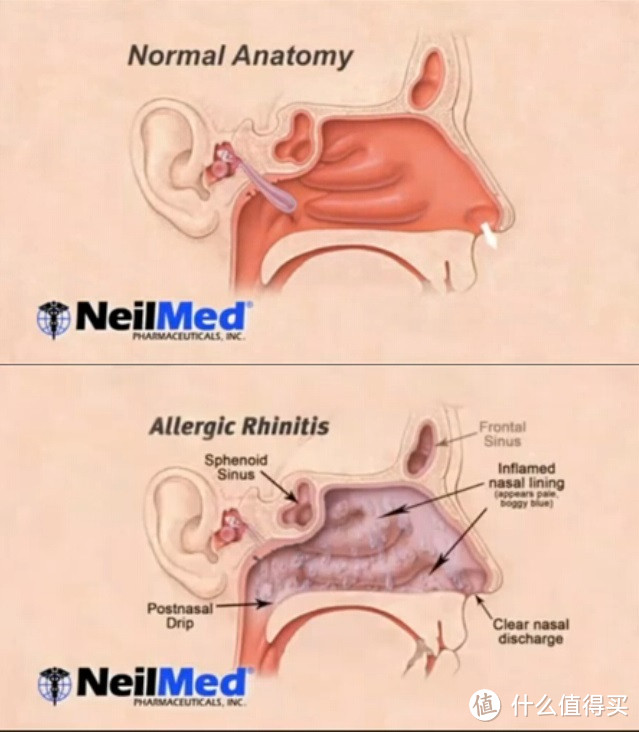 NeilMed 电动脉冲式洗鼻器，洗鼻盐安装以及使用感受