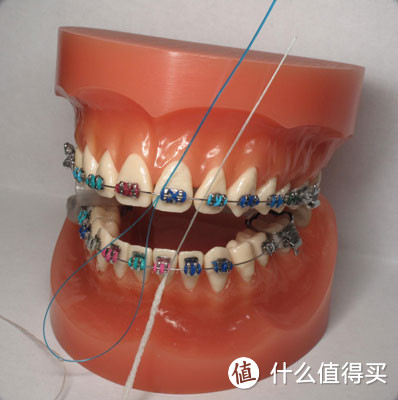 钢牙闪闪放光彩——说说正畸期间的心路历程和牙齿护理