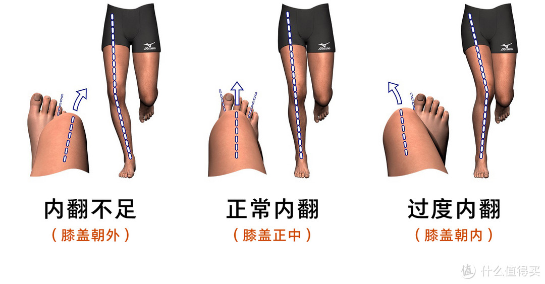 图3-4 不同脚掌内翻类型与跑姿的对应关系图