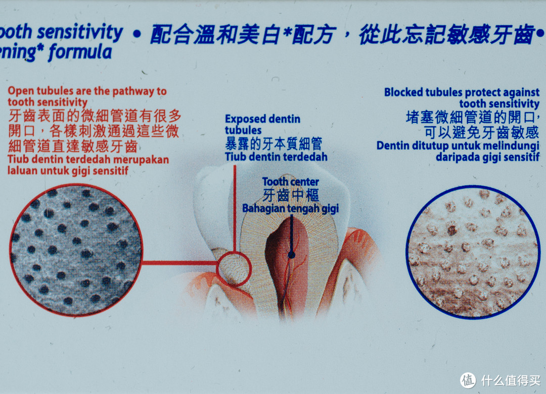牙龈炎、牙敏感？从原理到实战的护龈、抗敏牙膏 购物攻略