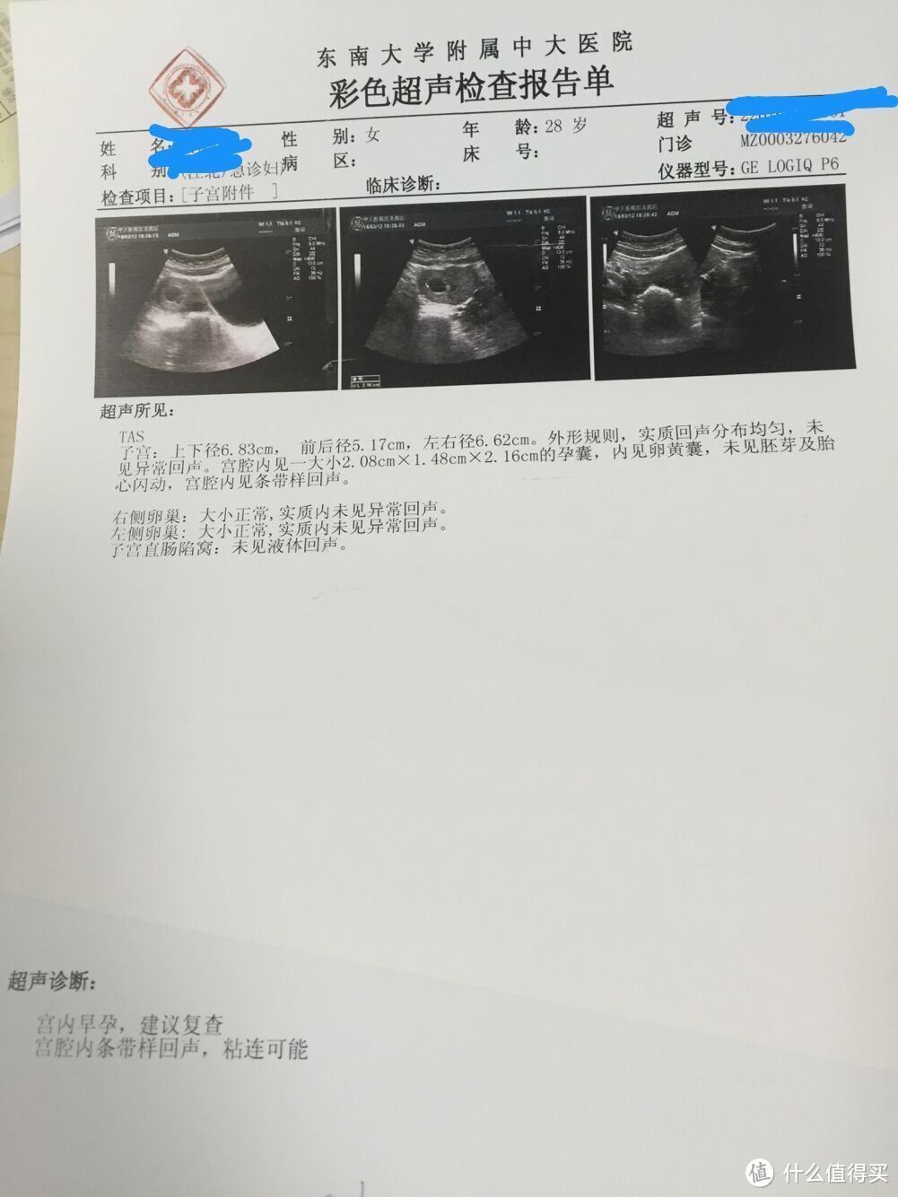 下次别跑太快，让我追上你！谈谈为了要宝宝悲惨的一件事