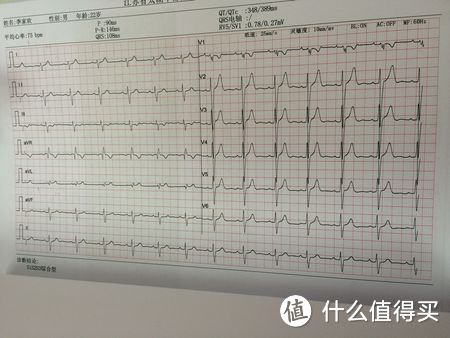 健康跑步，这里有你应该知道的一切