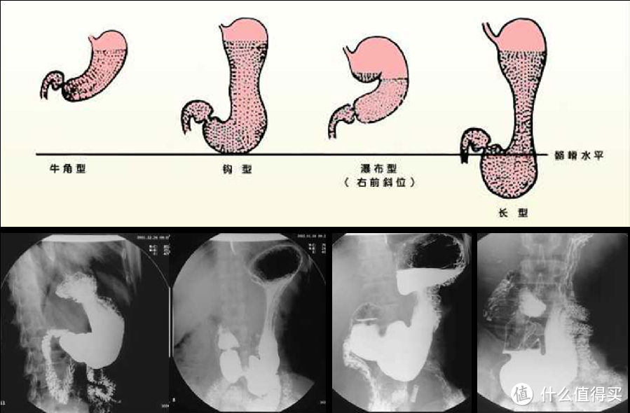 胃，你还好吗？