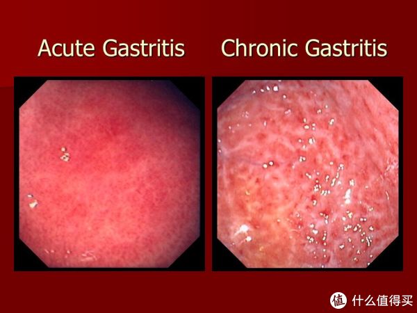 医科荃说系列 篇二:胃,你还好吗?