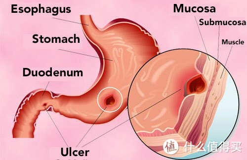 胃，你还好吗？