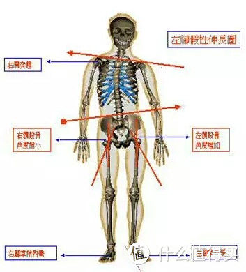 X型腿、身高变矮、下背痛可能跟它有关