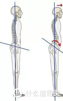 X型腿、身高变矮、下背痛可能跟它有关