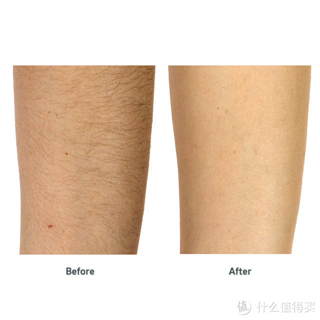 人类终极进化 Silk'n Flash & Go Hair Removal 家用脱毛器