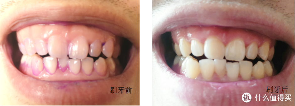 牙菌斑清除效果（欧乐B Pro4000）