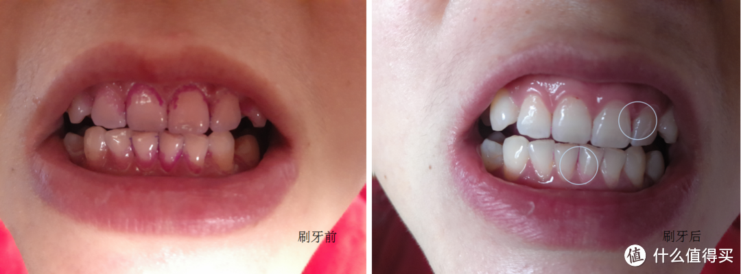 牙菌斑清除效果（欧乐B Pro4000）