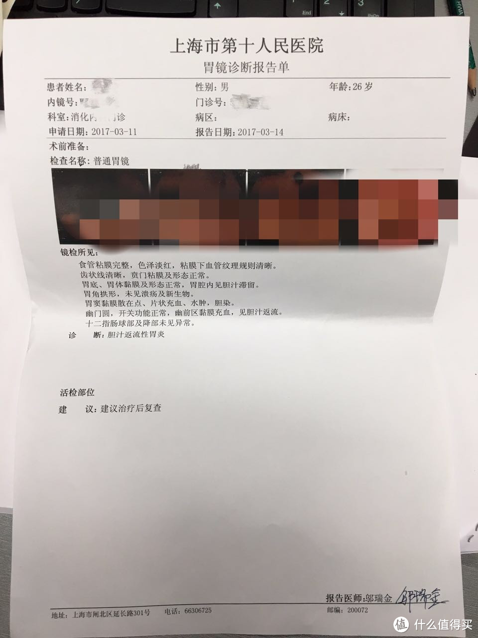 在买买买吃吃吃的同时保护好你的胃——记一次做胃镜的痛苦经历