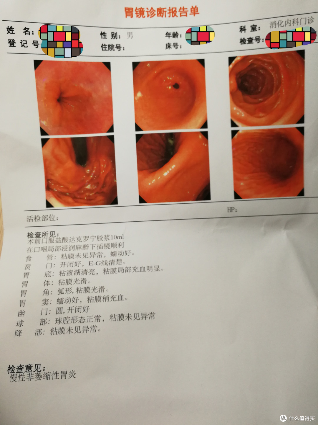 这是一个悲伤的故事——胃镜体验