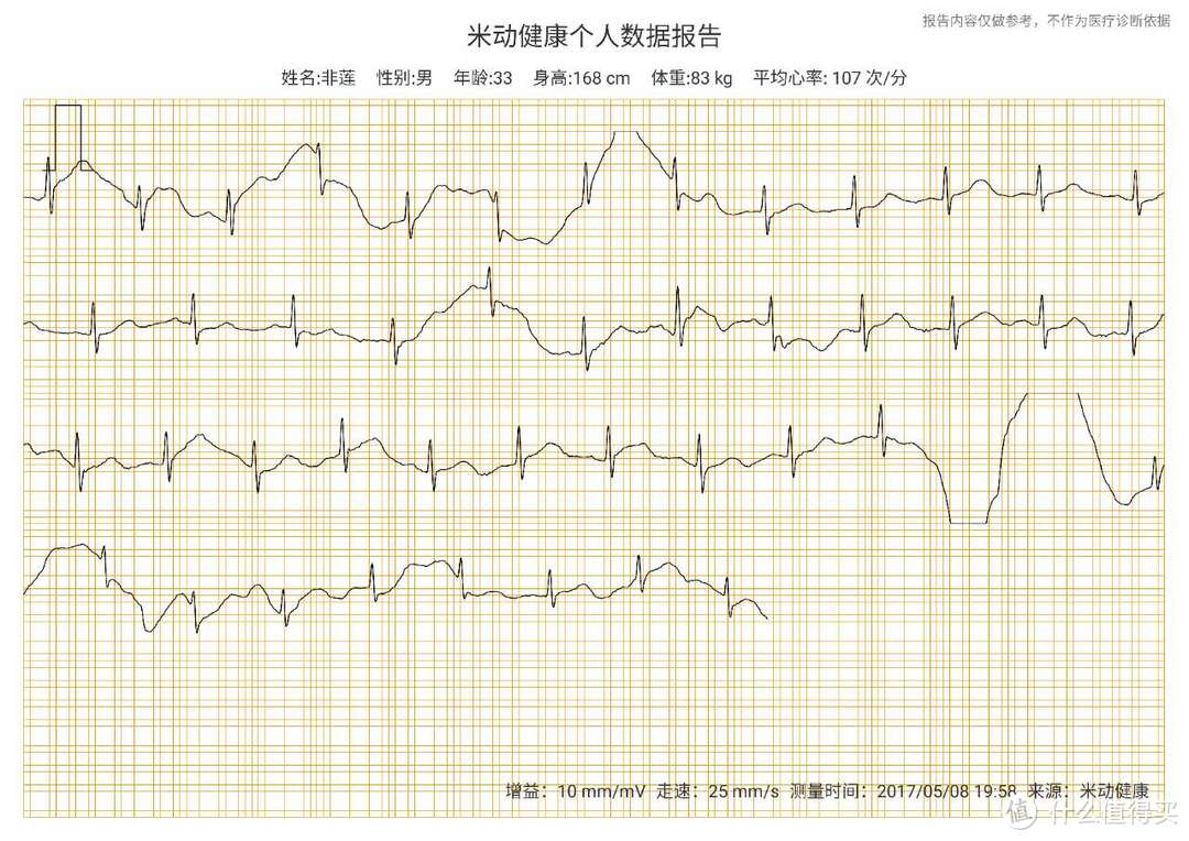 #原创新人# AMAZFIT 华米 运动健康手环 为健康埋单