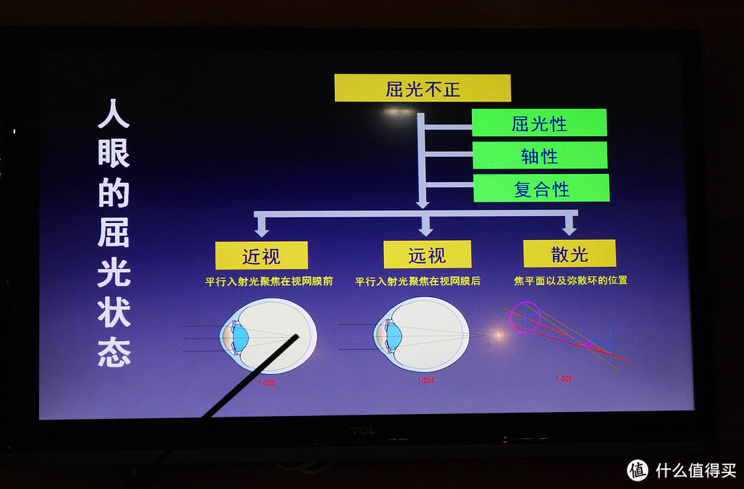 满满是干货，关于近视眼做手术你需要知道这些—SMZDM西安分舵线下活动