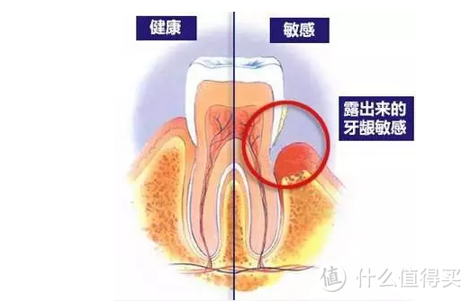 关于重新补牙和洗牙的故事