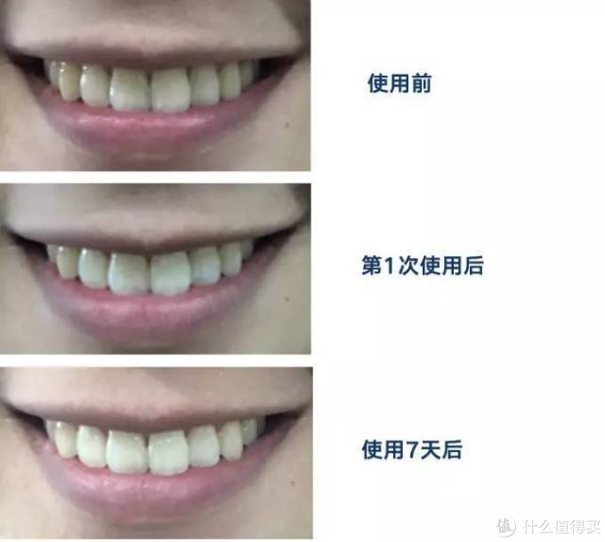 牙黄、牙渍星人的救星!试用了这些美白牙贴,一周真的有变白