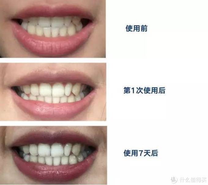 牙黄、牙渍星人的救星!试用了这些美白牙贴,一周真的有变白