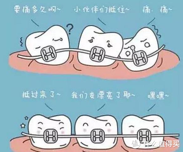 可能是最全的正畸原创文，附正畸用品清单