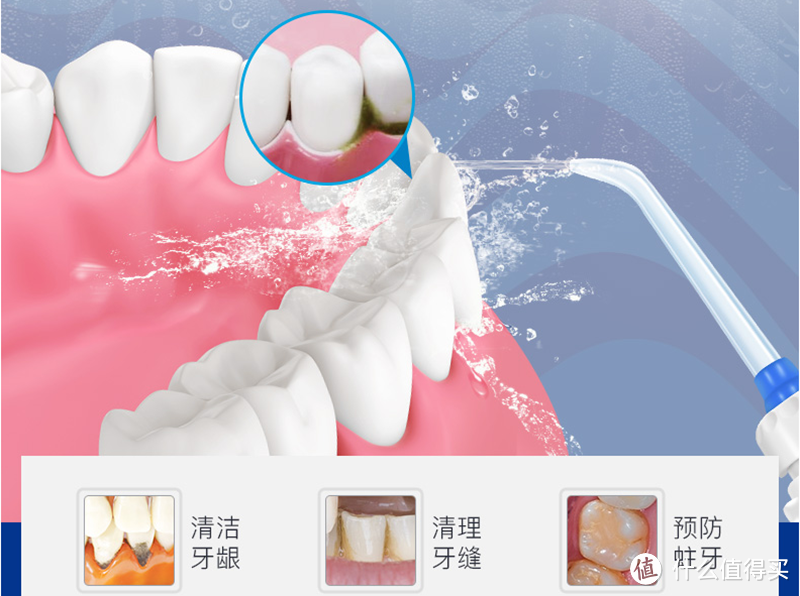 再见了我的牙周炎：XNUO 心诺 X809 家用冲牙器 体验记
