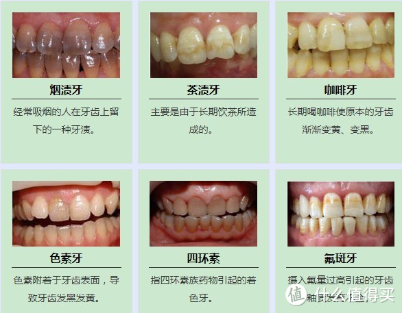 久病快成牙医的老患者，荐一波护牙&美牙的好物