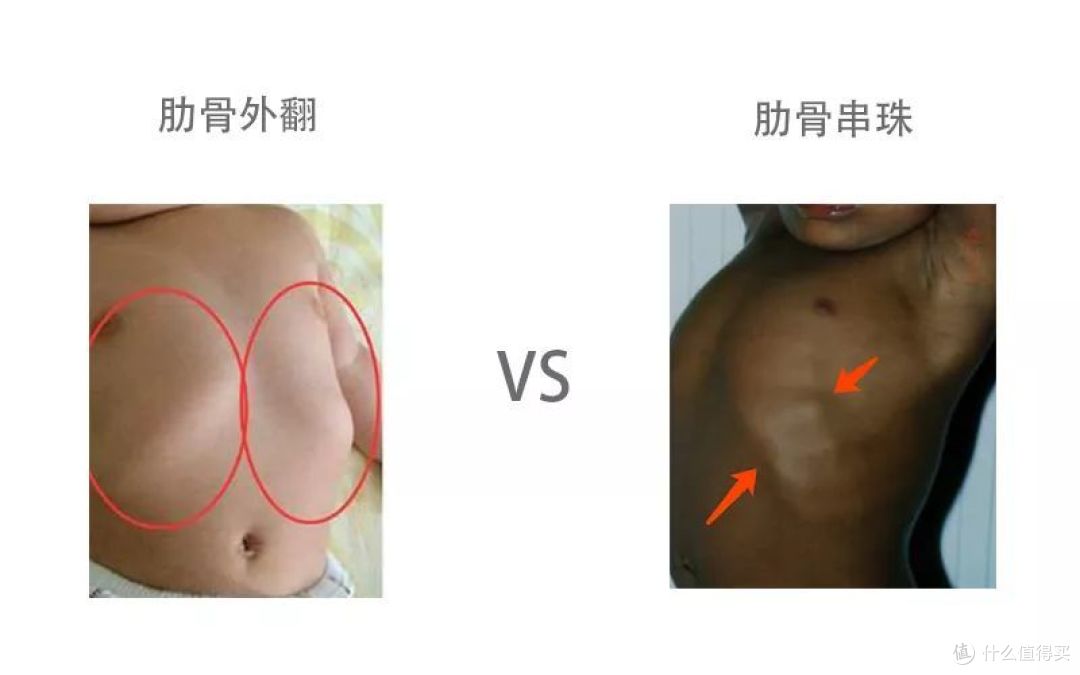 别再问宝宝补充剂了！读完这篇攻略，你也是半个营养师