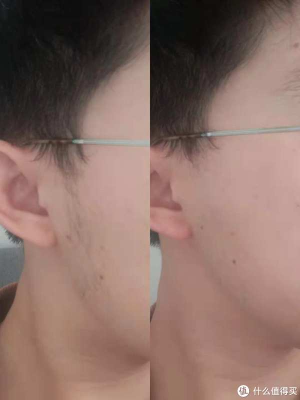 左（剃须前），右（剃须后）