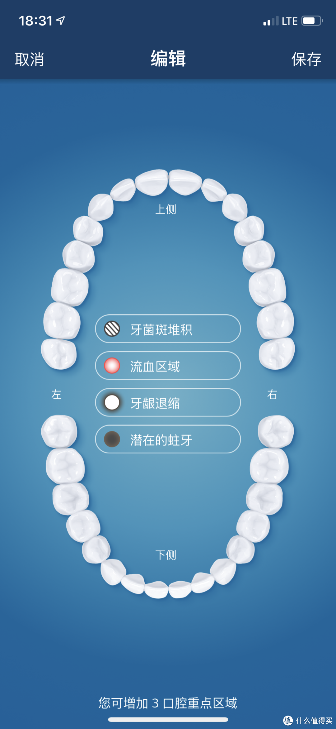 飞利浦电动牙刷93系列和99系列到底有啥区别？HX9903开箱报告