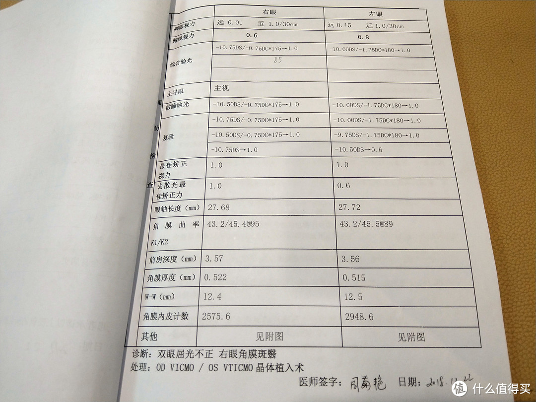 丢掉眼镜的你可以变得更美！——ICL手术检查分享