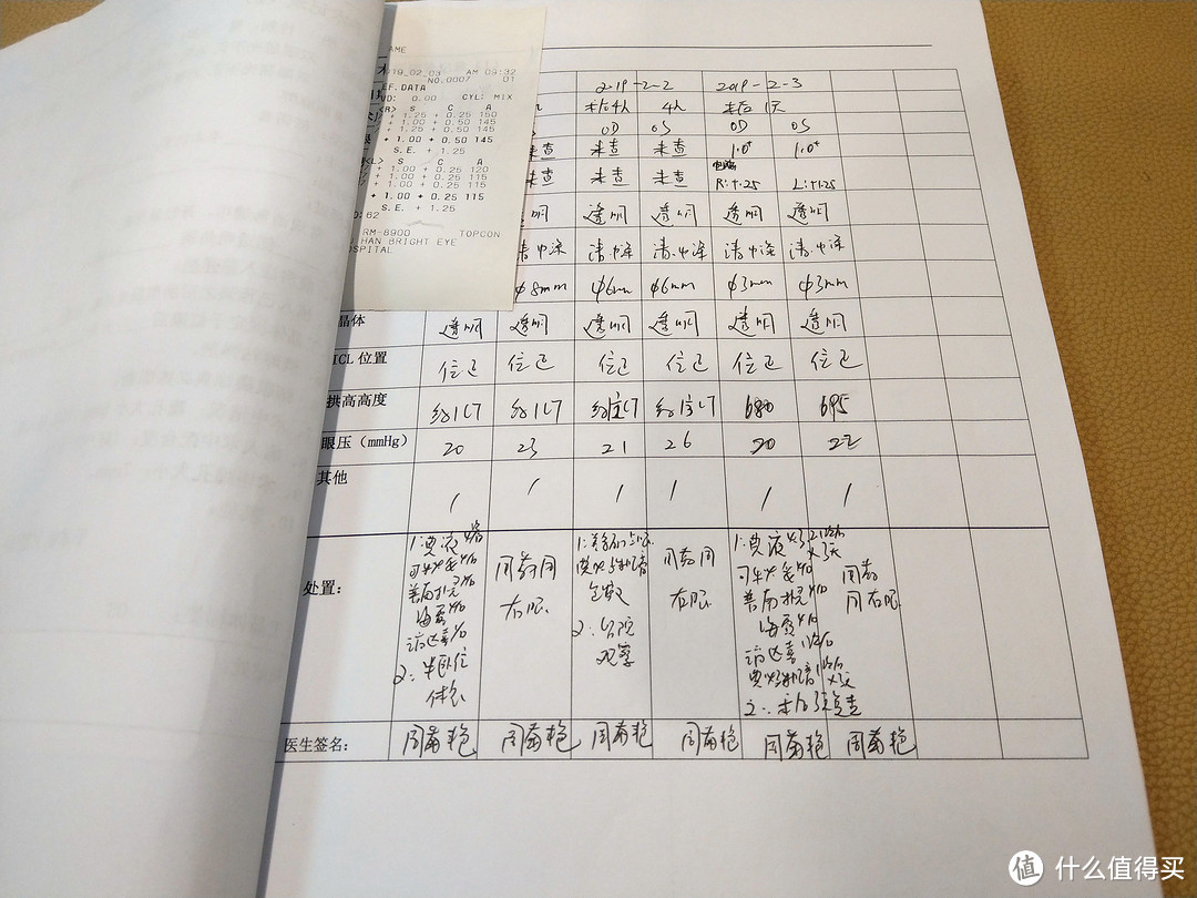 丢掉眼镜的你可以变得更美！——ICL手术检查分享