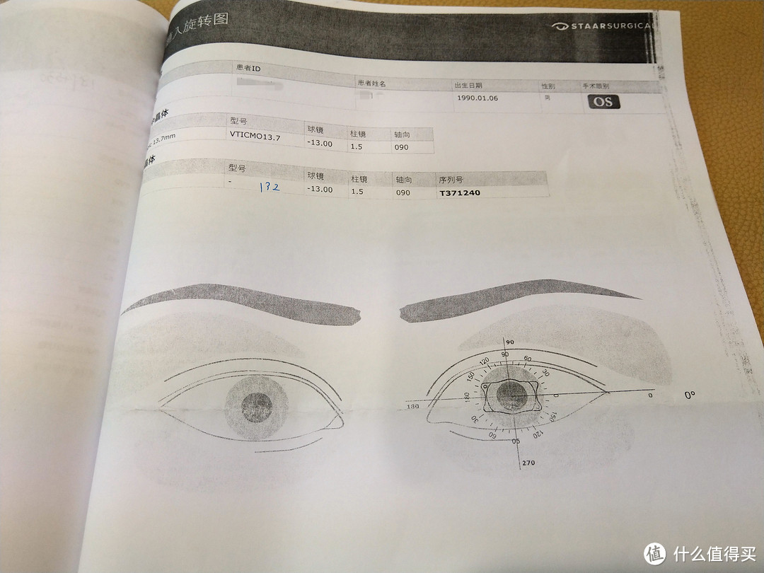 丢掉眼镜的你可以变得更美！——ICL手术检查分享