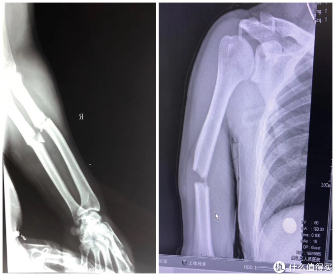 爱上粉雪后 冬眠是路人篇九 日本粉雪攻略之小川町 越后汤泽篇 苗场神乐 国外当地玩乐 什么值得买