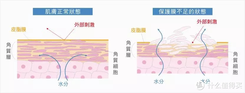 从根源上导致黑头和痘痘，是个害人精？