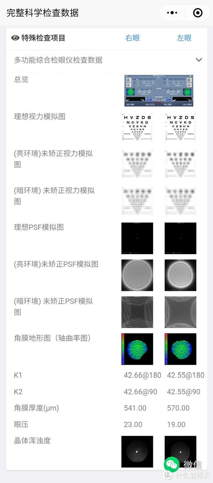 特殊检查项目 来源：阿嚏截图