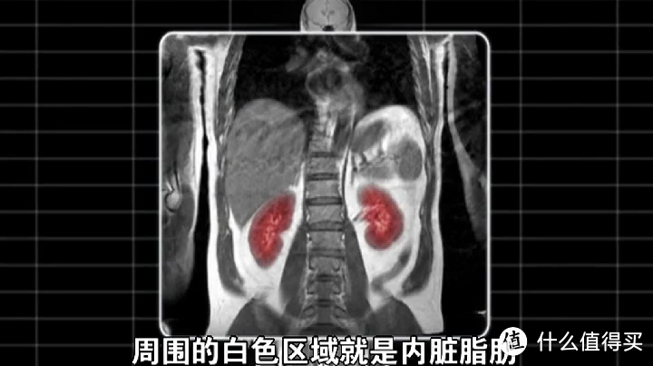 碳水、减肥、睡眠、健身•••9部国外纪录片，刷新你的健康认知！