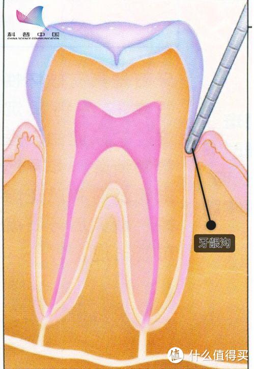 担心牙垢牙黄牙出血？看牙又太贵！这时一个冲牙器能解决你的问题