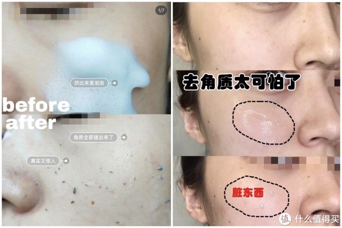 所有人都需要去角质吗 去角质的正确方法你知道多少 护肤精华 什么值得买 所有人都需要去角质吗 去角质的正确方法你知道多少 护肤精华 什么值得买