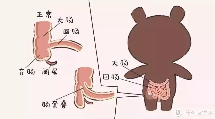 宝宝的便便能预示这些不良情况，家长的注意观察很重要！