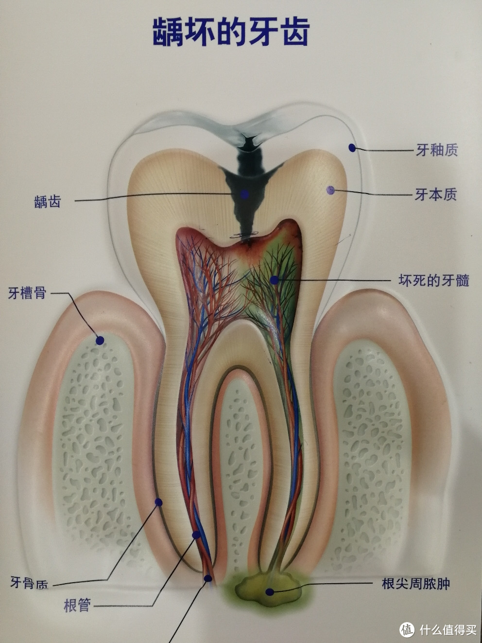 刷牙的正确打开方式，关于牙刷和牙膏的选择及牙齿小问题！