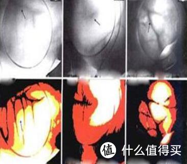 【减肥与健康 篇一】从8电极体脂秤来谈谈人体成分测量方法