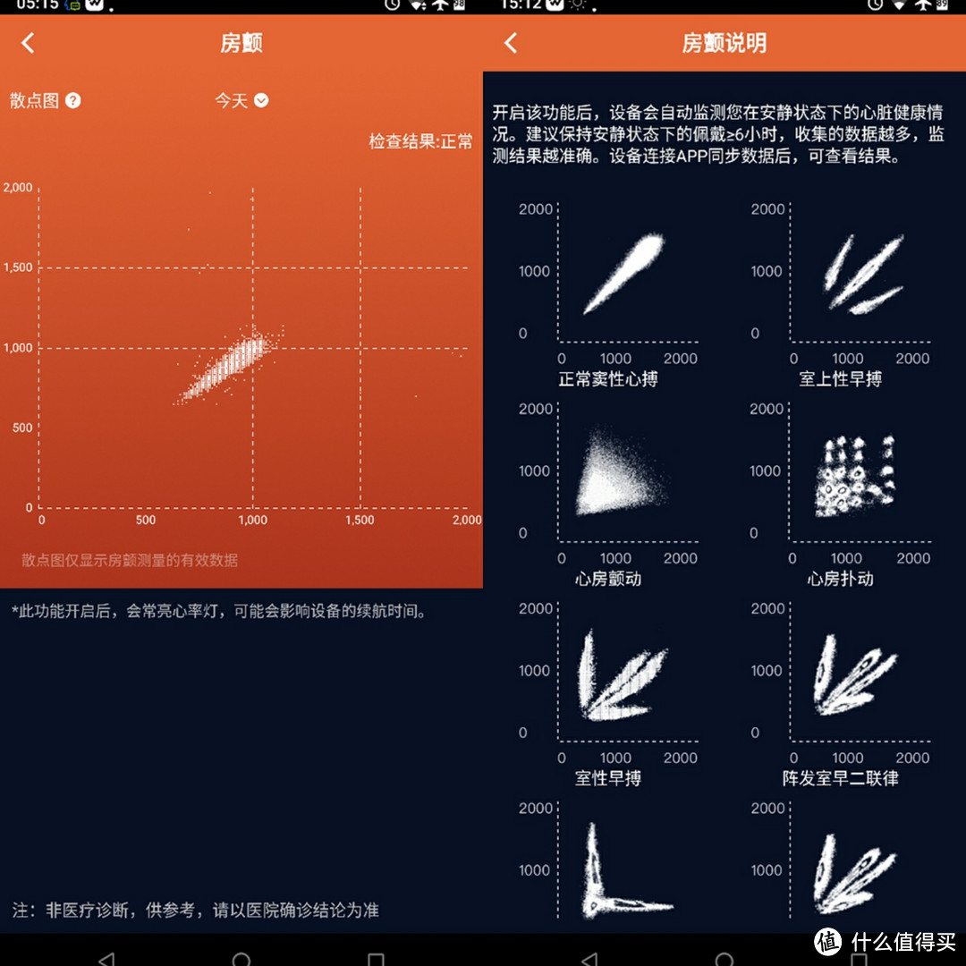 埃微CS200智能小手表使用体验