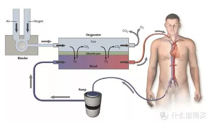 能“救命”的人工肺，你了解多少？
