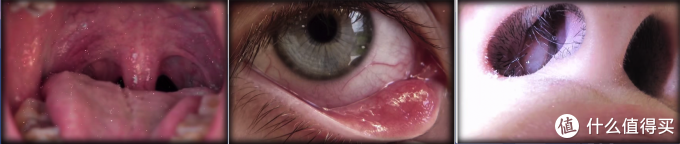 暴露在外的黏膜细胞,图片来自回形针「关于新冠肺炎的一切」