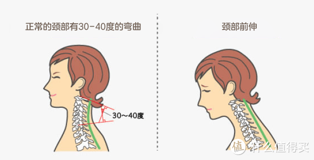 女生体态气质的头号杀手